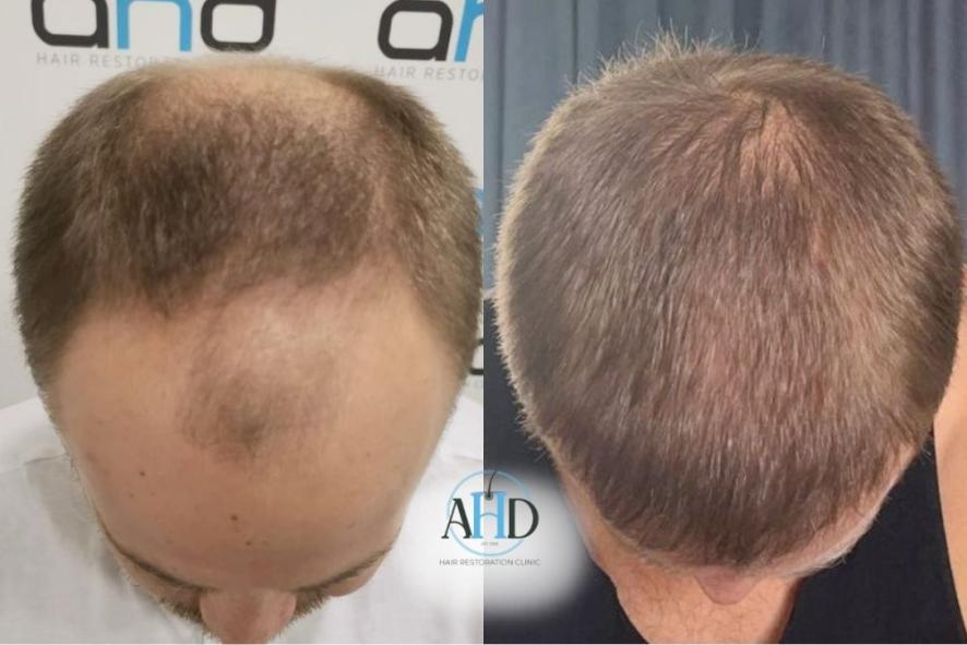 Click image for larger version

Name:	11.jpg
Views:	0
Size:	56.0 KB
ID:	540489