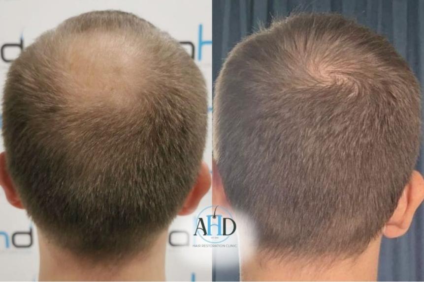 Click image for larger version

Name:	12.jpg
Views:	0
Size:	56.2 KB
ID:	540490