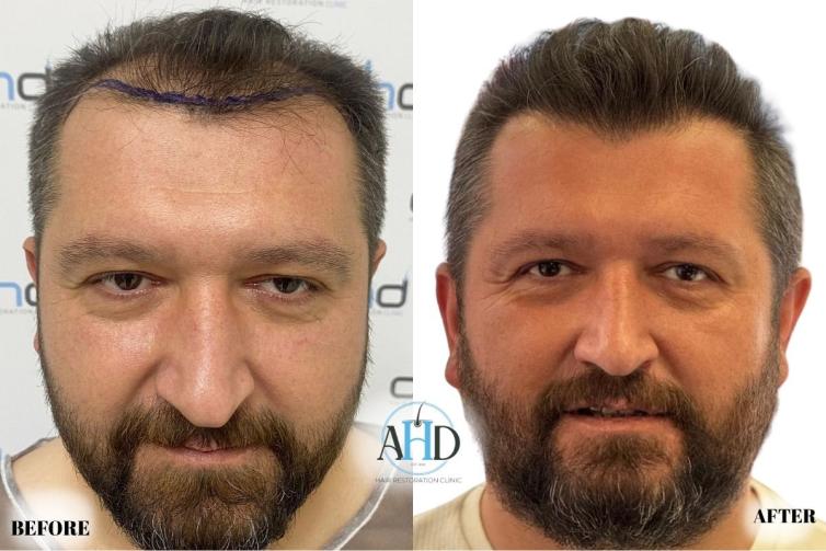 Click image for larger version

Name:	18.jpg
Views:	0
Size:	55.9 KB
ID:	540647