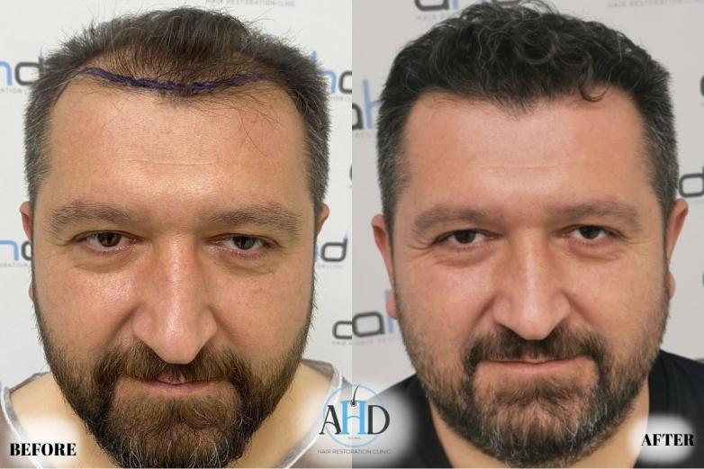 Click image for larger version

Name:	19.jpg
Views:	0
Size:	56.6 KB
ID:	540648