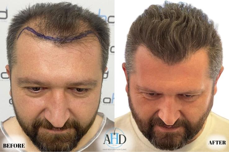 Click image for larger version

Name:	20.jpg
Views:	0
Size:	55.4 KB
ID:	540649