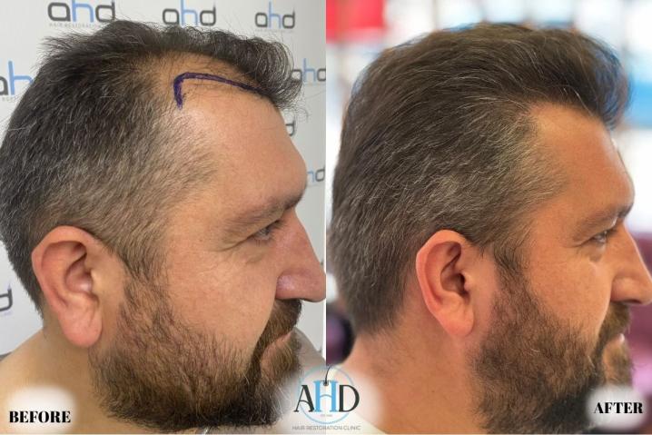 Click image for larger version

Name:	23.jpg
Views:	0
Size:	54.9 KB
ID:	540651