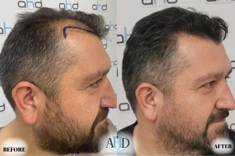 Click image for larger version

Name:	24.jpg
Views:	0
Size:	59.7 KB
ID:	540652