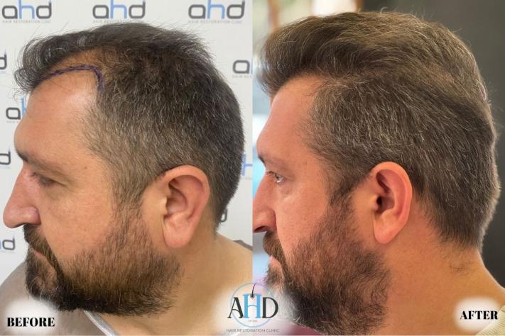 Click image for larger version

Name:	25.jpg
Views:	0
Size:	55.5 KB
ID:	540653