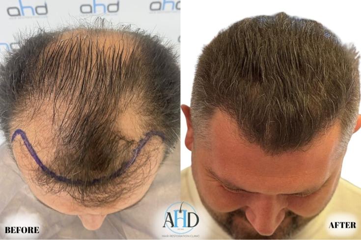 Click image for larger version

Name:	21.jpg
Views:	0
Size:	59.4 KB
ID:	540650