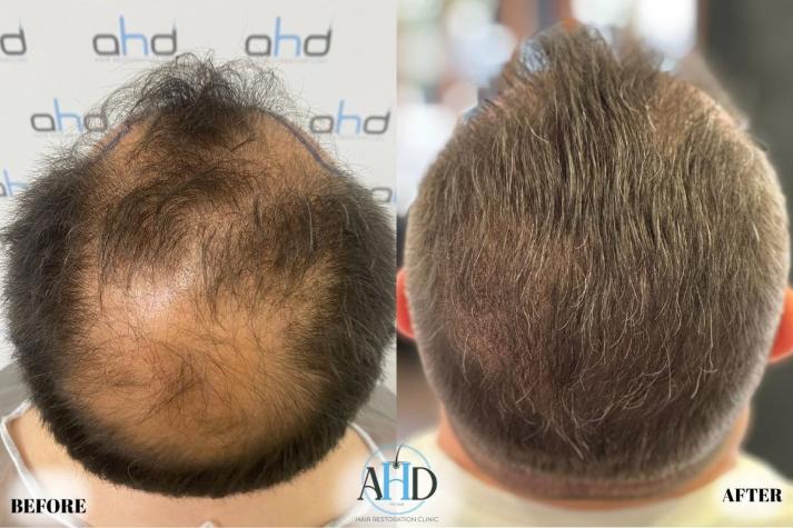 Click image for larger version

Name:	26.jpg
Views:	0
Size:	55.9 KB
ID:	540655