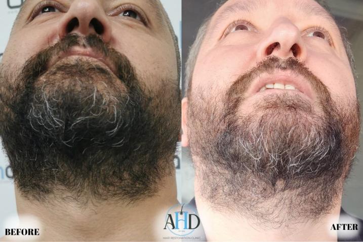 Click image for larger version

Name:	27.jpg
Views:	0
Size:	59.3 KB
ID:	540656