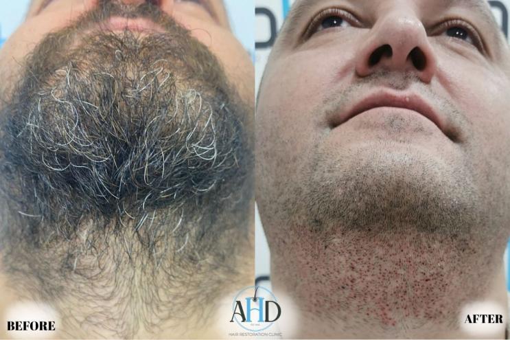 Click image for larger version

Name:	28.jpg
Views:	0
Size:	63.1 KB
ID:	540657