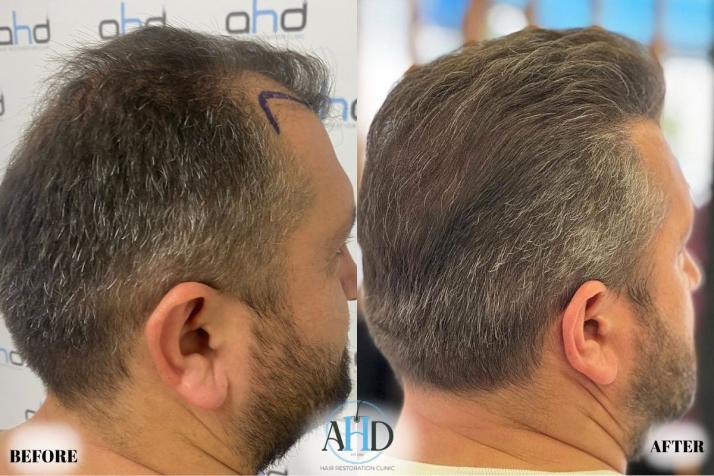 Click image for larger version

Name:	29.jpg
Views:	0
Size:	58.0 KB
ID:	540654