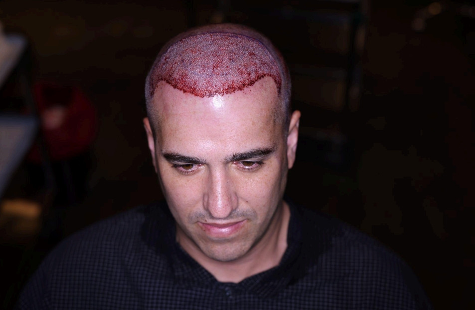 Click image for larger version

Name:	post op.jpg
Views:	0
Size:	88.1 KB
ID:	542213