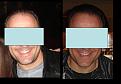 Click image for larger version

Name:	before-After.jpg
Views:	548
Size:	50.5 KB
ID:	432119