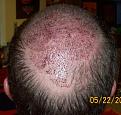 Click image for larger version

Name:	Back Head 3-Wong (Pics for net).jpg
Views:	1602
Size:	75.2 KB
ID:	432158