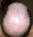 Click image for larger version

Name:	Back Head.jpg
Views:	1049
Size:	32.0 KB
ID:	432211