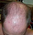 Click image for larger version

Name:	Top Head 2.jpg
Views:	1436
Size:	29.0 KB
ID:	432212