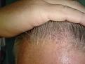 Click image for larger version

Name:	hair 003.jpg
Views:	398
Size:	87.7 KB
ID:	432215