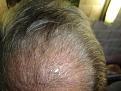 Click image for larger version

Name:	hair 004.jpg
Views:	405
Size:	92.7 KB
ID:	432216