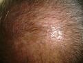 Click image for larger version

Name:	hairday16.jpg
Views:	348
Size:	84.7 KB
ID:	432218