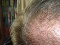 Click image for larger version

Name:	hair 011.jpg
Views:	333
Size:	92.8 KB
ID:	432219