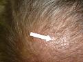 Click image for larger version

Name:	hair.jpg
Views:	396
Size:	88.5 KB
ID:	432221
