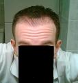 Click image for larger version

Name:	3 Months Front  1.jpg
Views:	1691
Size:	14.9 KB
ID:	432223