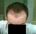 Click image for larger version

Name:	3 Months Top.jpg
Views:	1921
Size:	20.7 KB
ID:	432226
