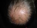 Click image for larger version

Name:	hair 080.jpg
Views:	404
Size:	95.1 KB
ID:	432245