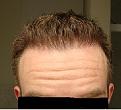 Click image for larger version

Name:	5 Months - Front 2 .jpg
Views:	1947
Size:	19.2 KB
ID:	432252