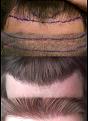 Click image for larger version

Name:	hair1.jpg
Views:	562
Size:	57.5 KB
ID:	432257