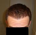 Click image for larger version

Name:	6 months - front 3.jpg
Views:	1152
Size:	91.2 KB
ID:	432260