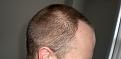 Click image for larger version

Name:	Week 2 - Right.jpg
Views:	593
Size:	94.1 KB
ID:	432286
