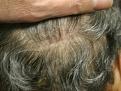 Click image for larger version

Name:	scars4.jpg
Views:	1432
Size:	80.0 KB
ID:	432328