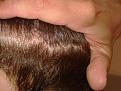 Click image for larger version

Name:	5,8 months - scar-wet hair.jpg
Views:	1488
Size:	94.7 KB
ID:	432332