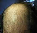 Click image for larger version

Name:	hairface.jpg
Views:	577
Size:	88.9 KB
ID:	432357