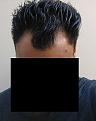 Click image for larger version

Name:	pre op.jpg
Views:	682
Size:	48.6 KB
ID:	432371