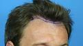 Click image for larger version

Name:	pre%20hairline.jpg
Views:	2924
Size:	28.8 KB
ID:	432703