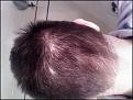 Click image for larger version

Name:	backofhead2.jpg
Views:	1774
Size:	16.2 KB
ID:	432720