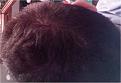 Click image for larger version

Name:	topofhead3.jpeg
Views:	1050
Size:	15.0 KB
ID:	432724