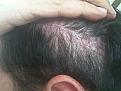 Click image for larger version

Name:	Three month mark-11.jpg
Views:	593
Size:	39.0 KB
ID:	432756