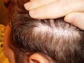 Click image for larger version

Name:	Hair Nov 2010 006.jpg
Views:	2032
Size:	96.3 KB
ID:	432773