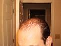 Click image for larger version

Name:	Hair Nov 2010 007.jpg
Views:	2277
Size:	104.2 KB
ID:	432774