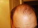 Click image for larger version

Name:	Hair Nov 2010 008.jpg
Views:	2557
Size:	96.7 KB
ID:	432775