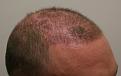 Click image for larger version

Name:	post op 3 weeks 3.jpg
Views:	648
Size:	32.8 KB
ID:	432778