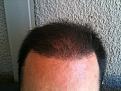 Click image for larger version

Name:	Hair_4Mnth-1.jpg
Views:	925
Size:	84.8 KB
ID:	432809