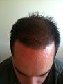 Click image for larger version

Name:	Hair_4Mnth-4.jpg
Views:	971
Size:	70.2 KB
ID:	432810