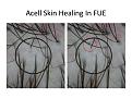 Click image for larger version

Name:	Slide1.jpg
Views:	678
Size:	80.3 KB
ID:	432838