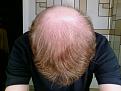 Click image for larger version

Name:	14 months after.jpg
Views:	675
Size:	69.6 KB
ID:	433165