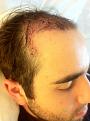 Click image for larger version

Name:	side post-op.jpg
Views:	607
Size:	101.2 KB
ID:	433199