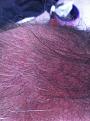 Click image for larger version

Name:	June 16 3 months post op.jpg
Views:	615
Size:	96.5 KB
ID:	433214