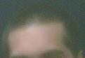 Click image for larger version

Name:	hairline26.jpg
Views:	448
Size:	2.4 KB
ID:	433249