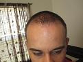 Click image for larger version

Name:	IMG_2550.jpg
Views:	505
Size:	88.2 KB
ID:	433265